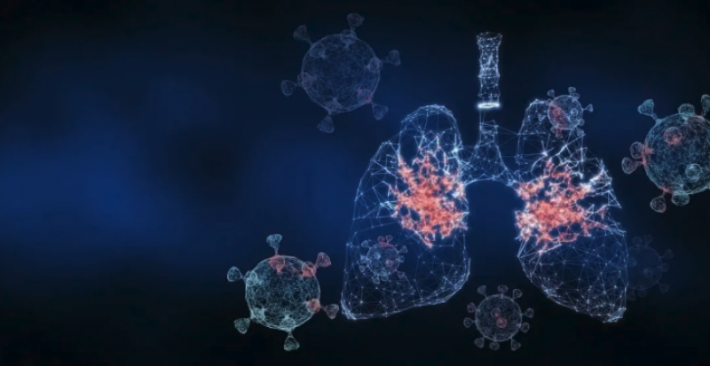 Depicting virus in the lungs